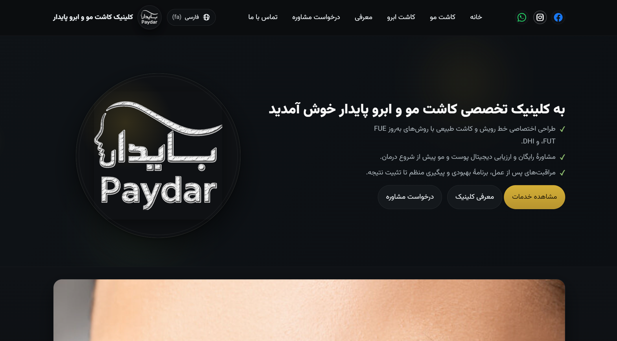 کاشت مو و ابرو بایدار